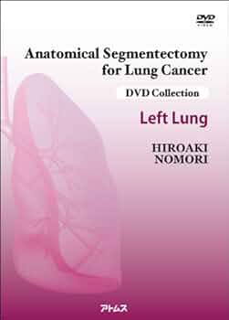 Anatomical Segmentectomy for Lung Cancer【Left  Lung】-肺癌の解剖学的区域切除【左肺編】-[DVD-Video] (DVD collection)